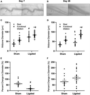 Collateral Arteriogenesis Involves a Sympathetic Denervation That Is Associated With Abnormal α-Adrenergic Signaling and a Transient Loss of Vascular Tone